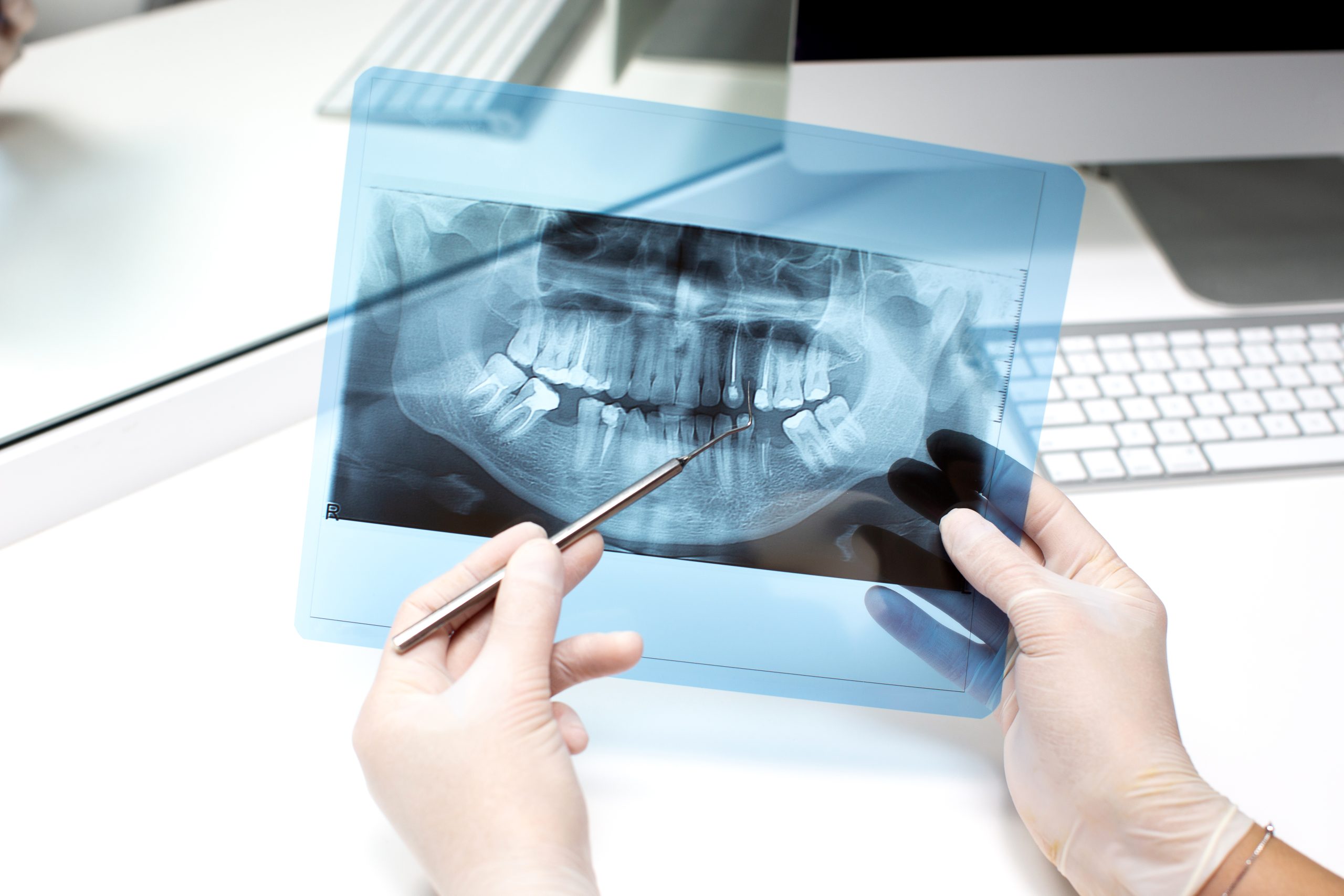 Dental X-ray Richmond, TX | Best Dental