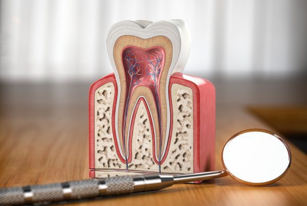 5 Signs You Need A Root Canal | Best Dental