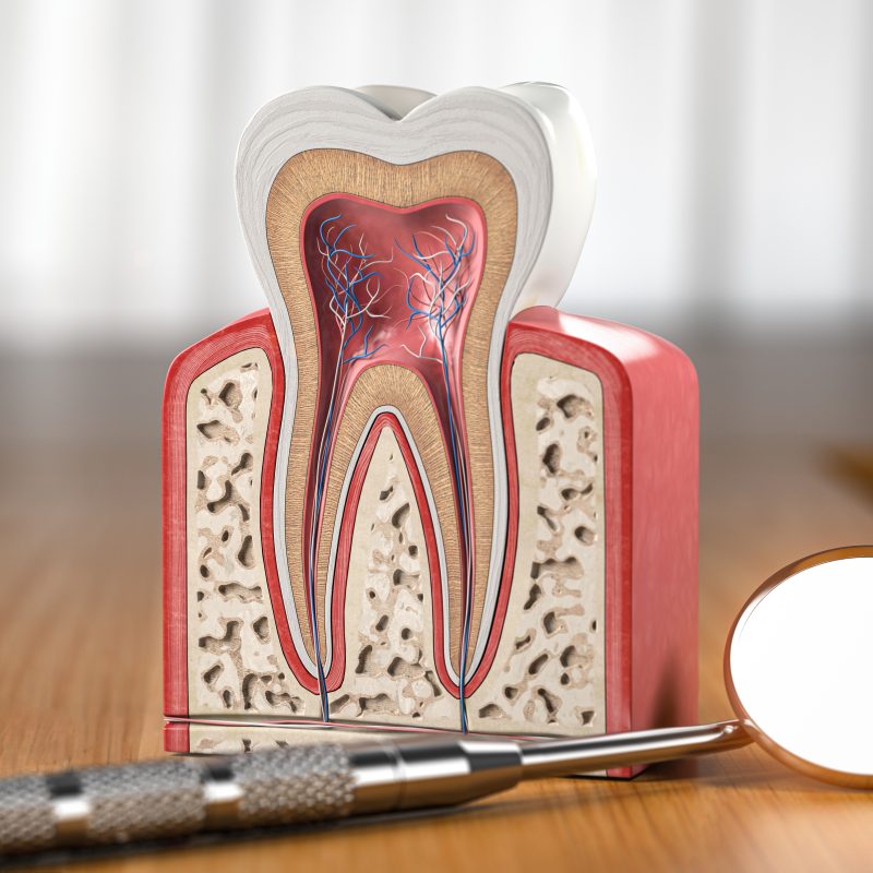 5 Signs You Need A Root Canal | Best Dental
