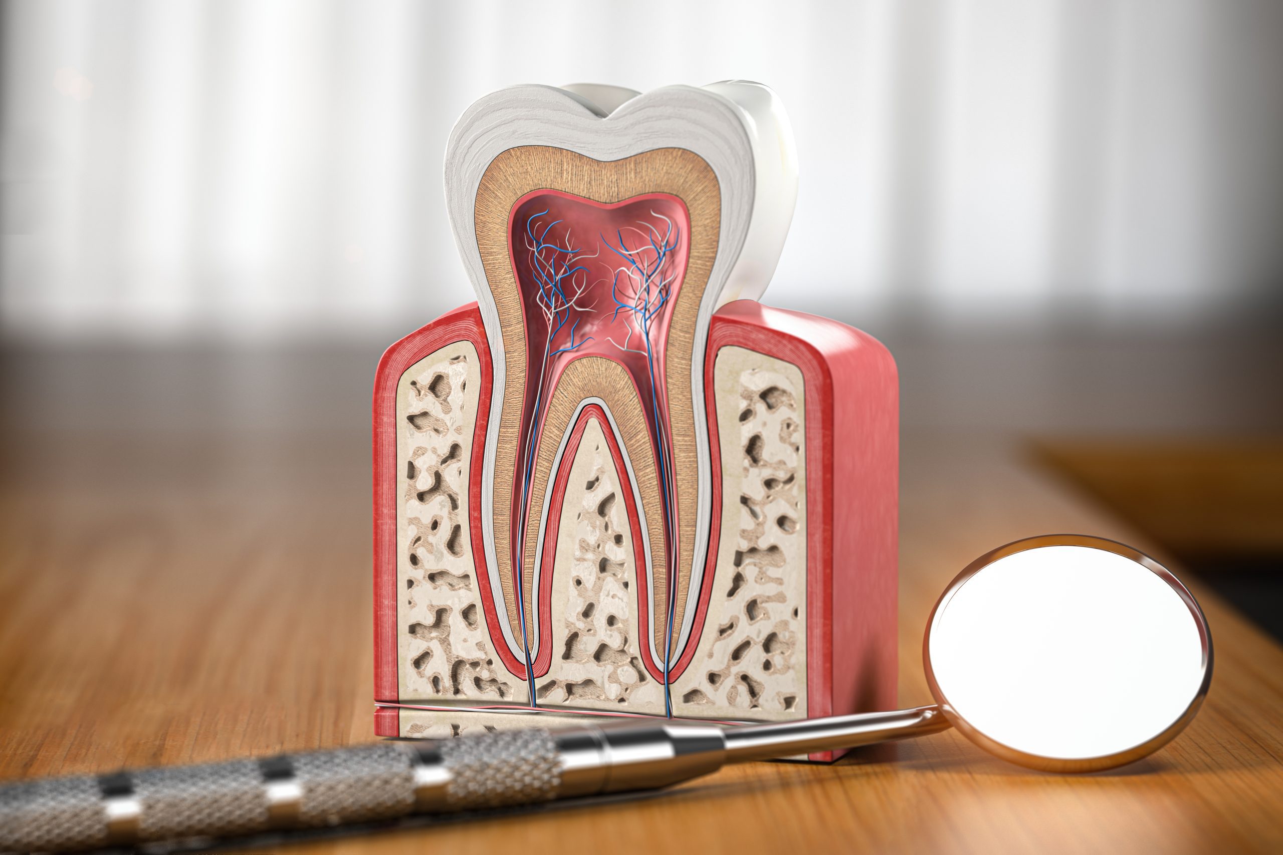 5 Signs You Need a Root Canal