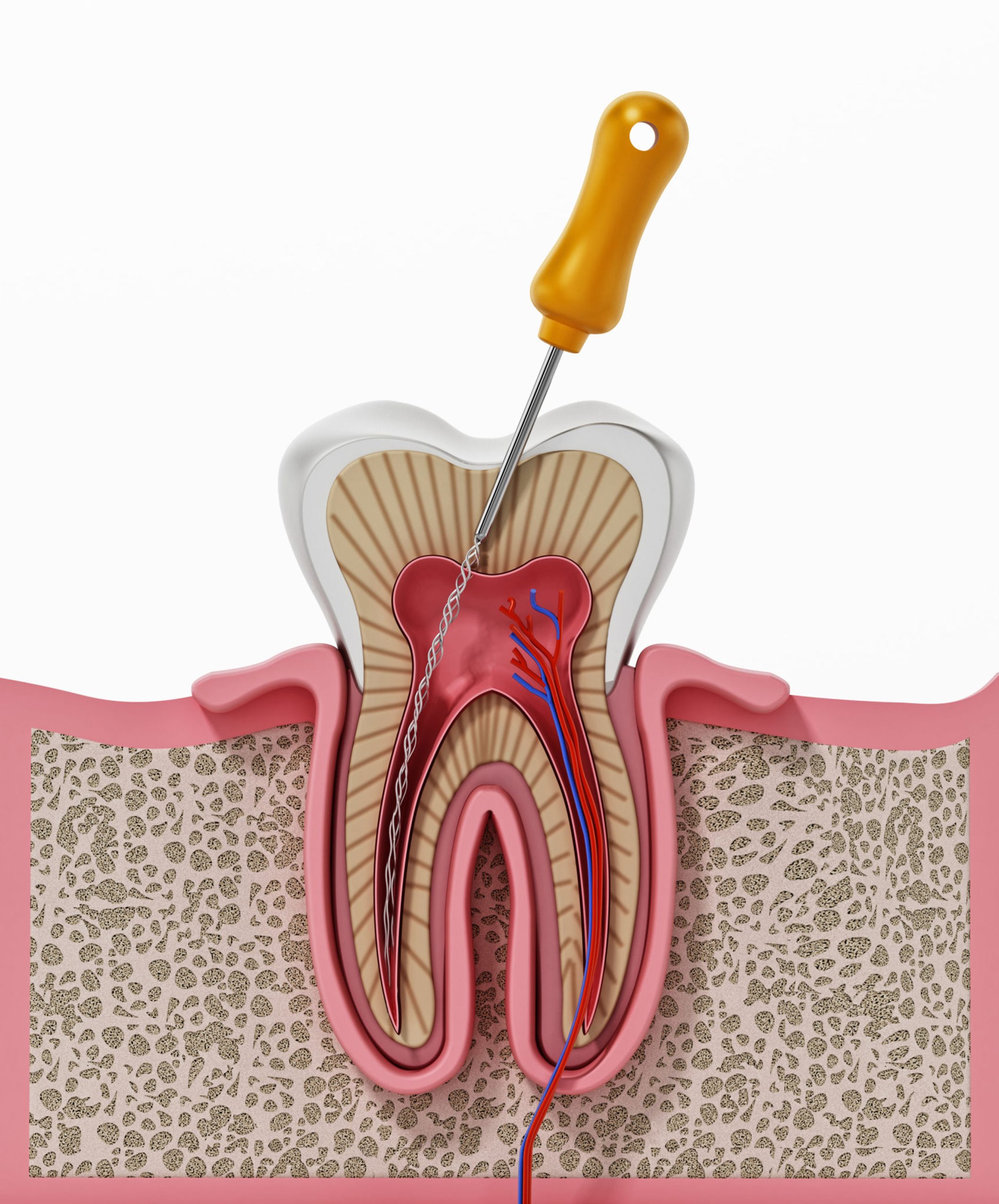 Signs you may need a root canal — Best Dental Richmond TX