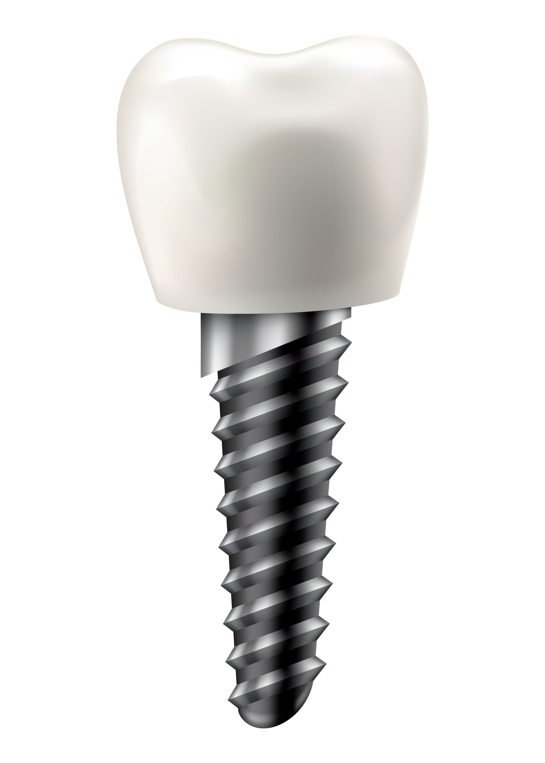 Preparing For Dental Implant Surgery | Best Dental
