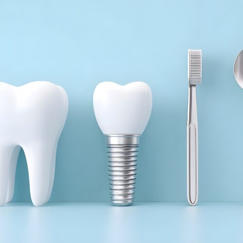 dental implant