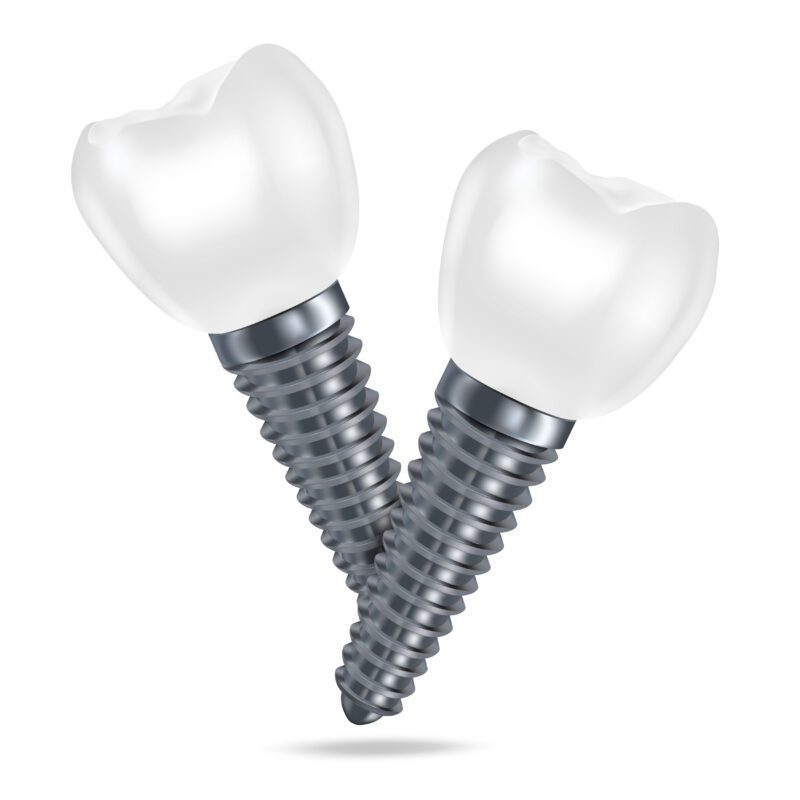 Dental Implants vs Dental Bridges | Best Dental Richmond, TX