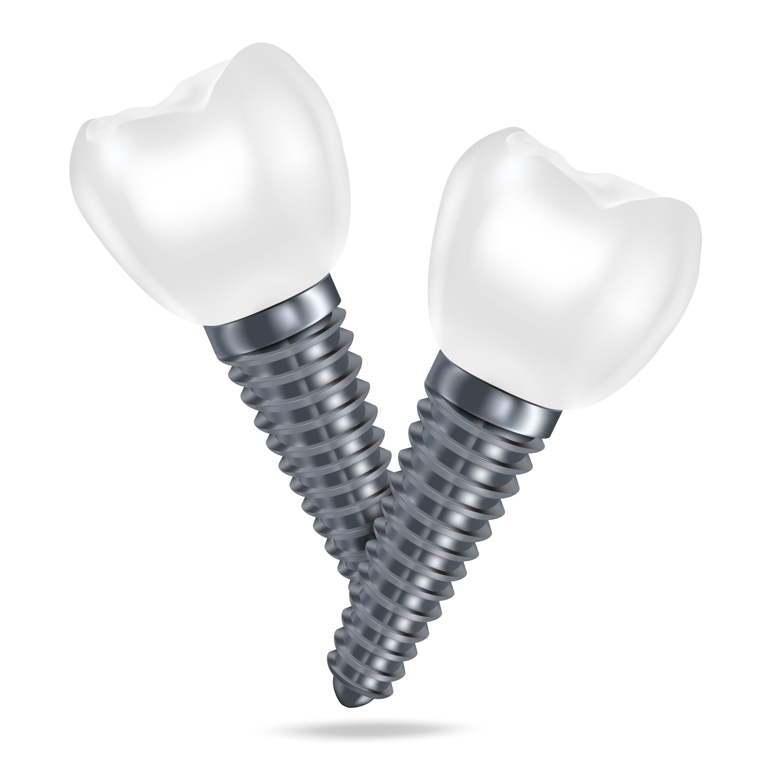 Dental Implants Vs Dental Bridges For Richmond Residents – Why We Favor Dental Implants