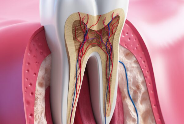 Root Canal Cost Richmond, TX | Best Dental