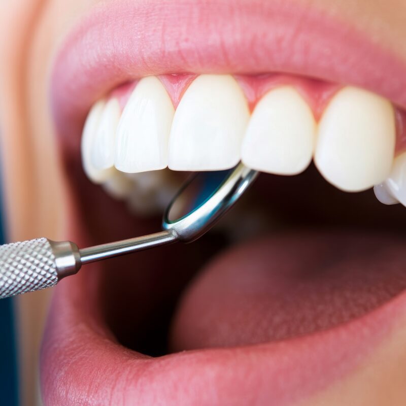 Dental Anxiety | Best Dental Richmond, TX