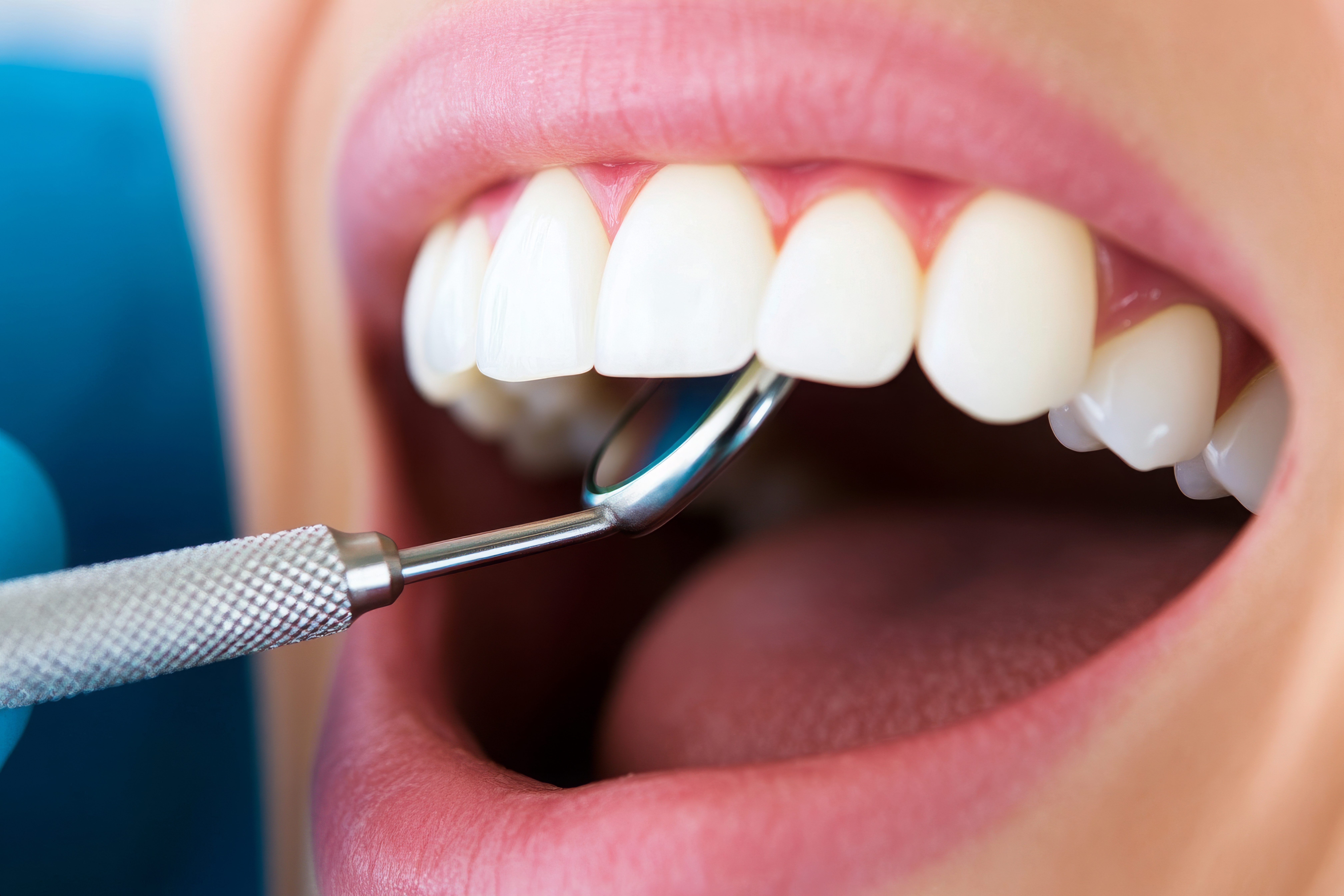 Dental Anxiety In Richmond, TX?