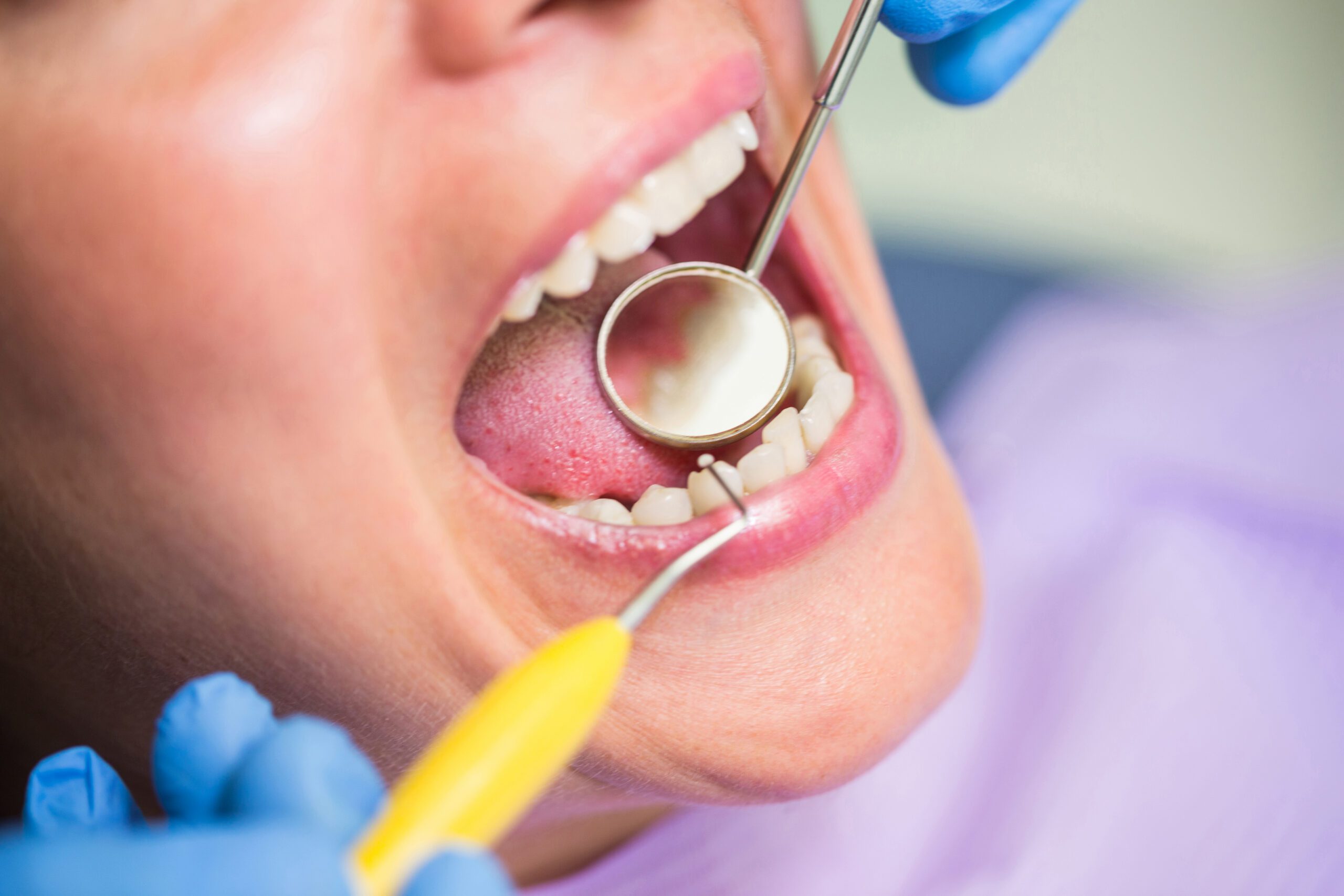 Youth Sports Dental Injuries – A Guide For Richmond, TX Residents