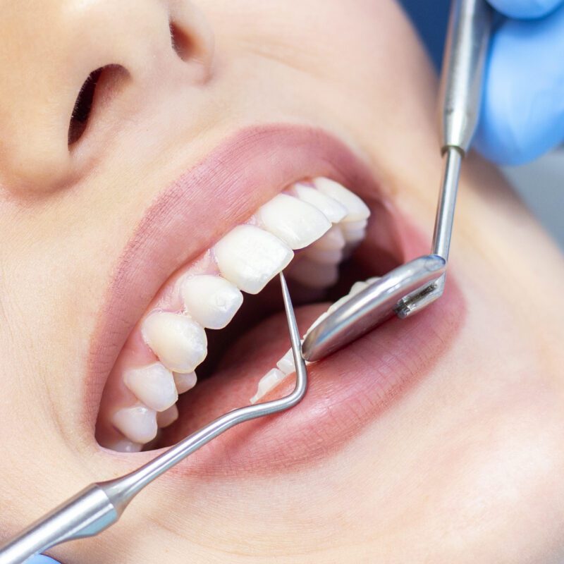 Sedation Dentist Cost Richmond, TX | Best Dental