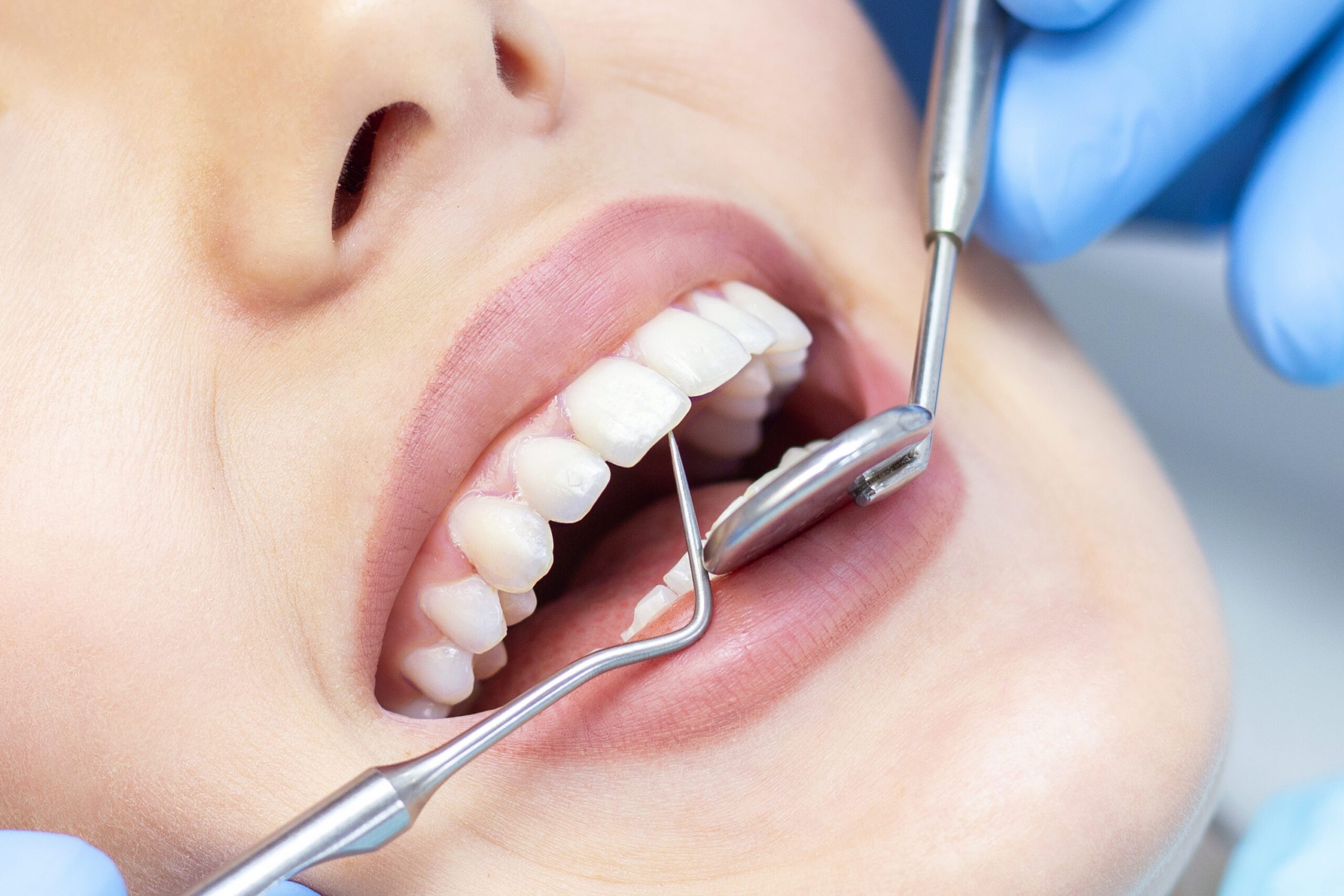 How Much Does Sedation Dentistry Cost In Richmond, TX?