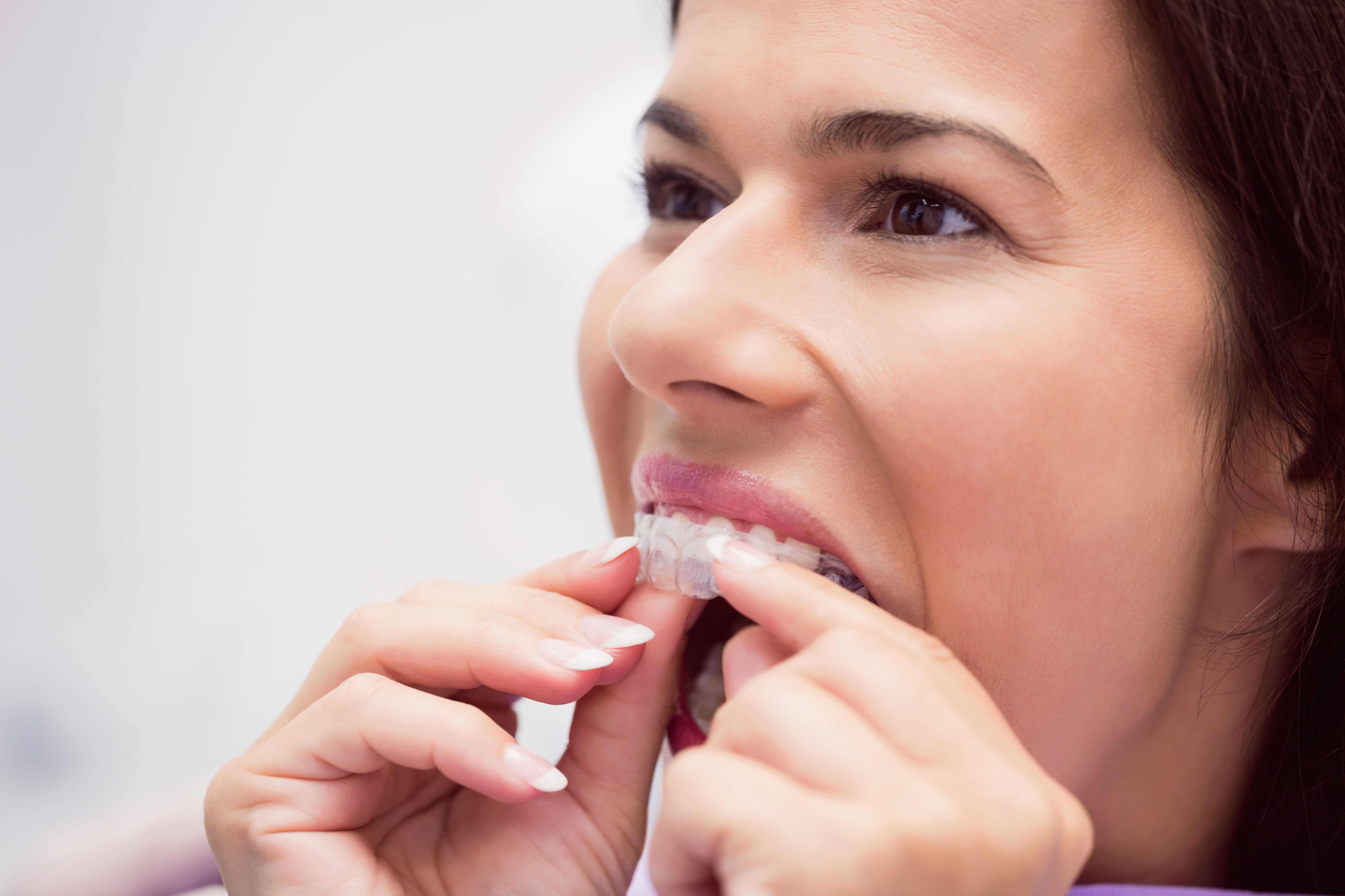 Invisalign Payment Plans In Richmond, TX