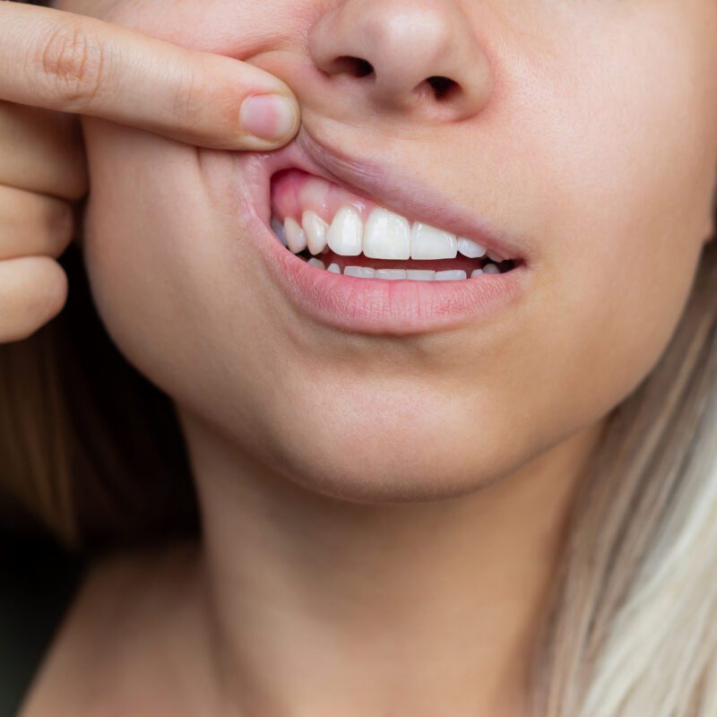 What emergency rooms can and can't do for dental problems | Best Dental