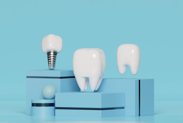 What Houston Residents Can Expect from Dental Implant Surgery | Best Dental