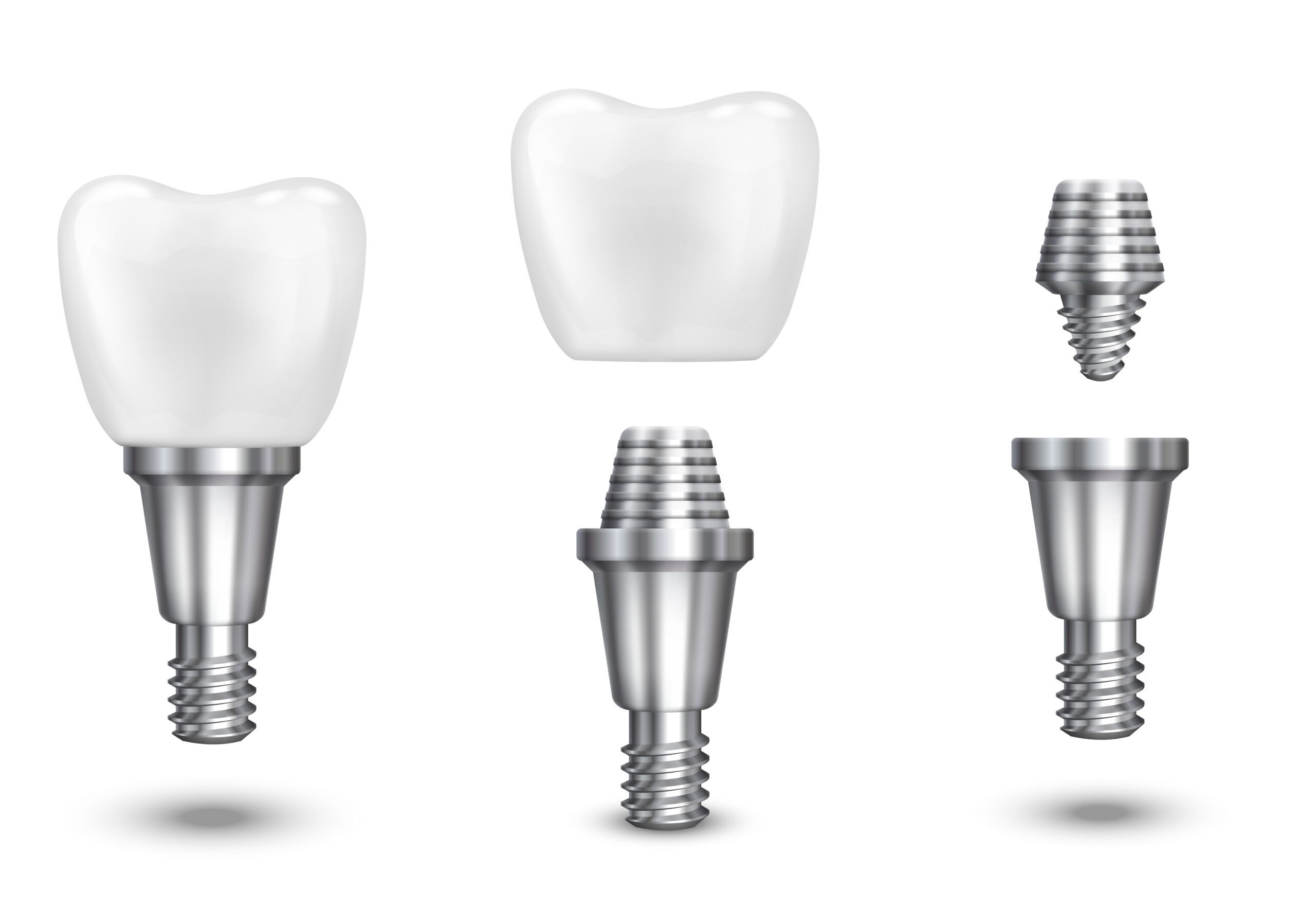 Dental implants near Sugar Land TX — Best Dental Richmond