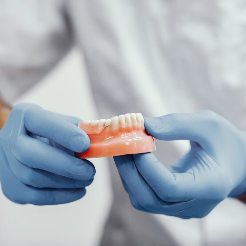 Partial Dentures Cost in Houston, TX | Best Dental