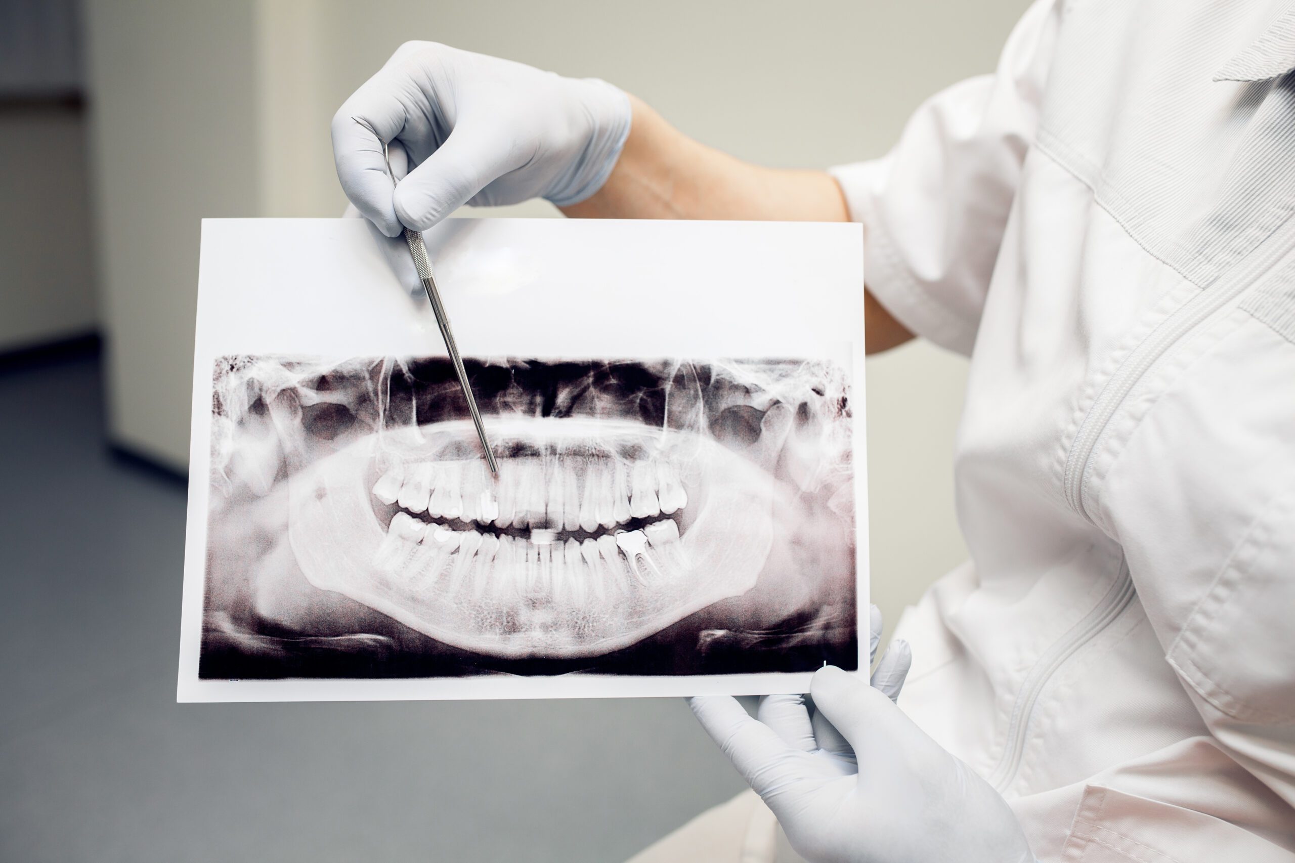 How Much Does A Dental Bridge Cost In Katy, TX?