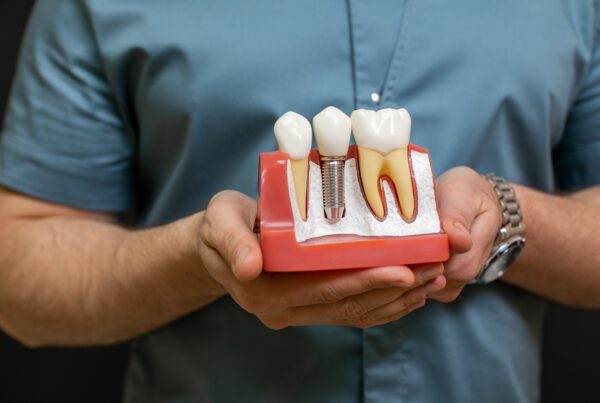 Dental Implants Cost Houston TX | $1,995 All-In | Best Dental