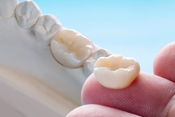 Dental Crown Cost in Rosenberg, TX — Affordable Crowns Near You