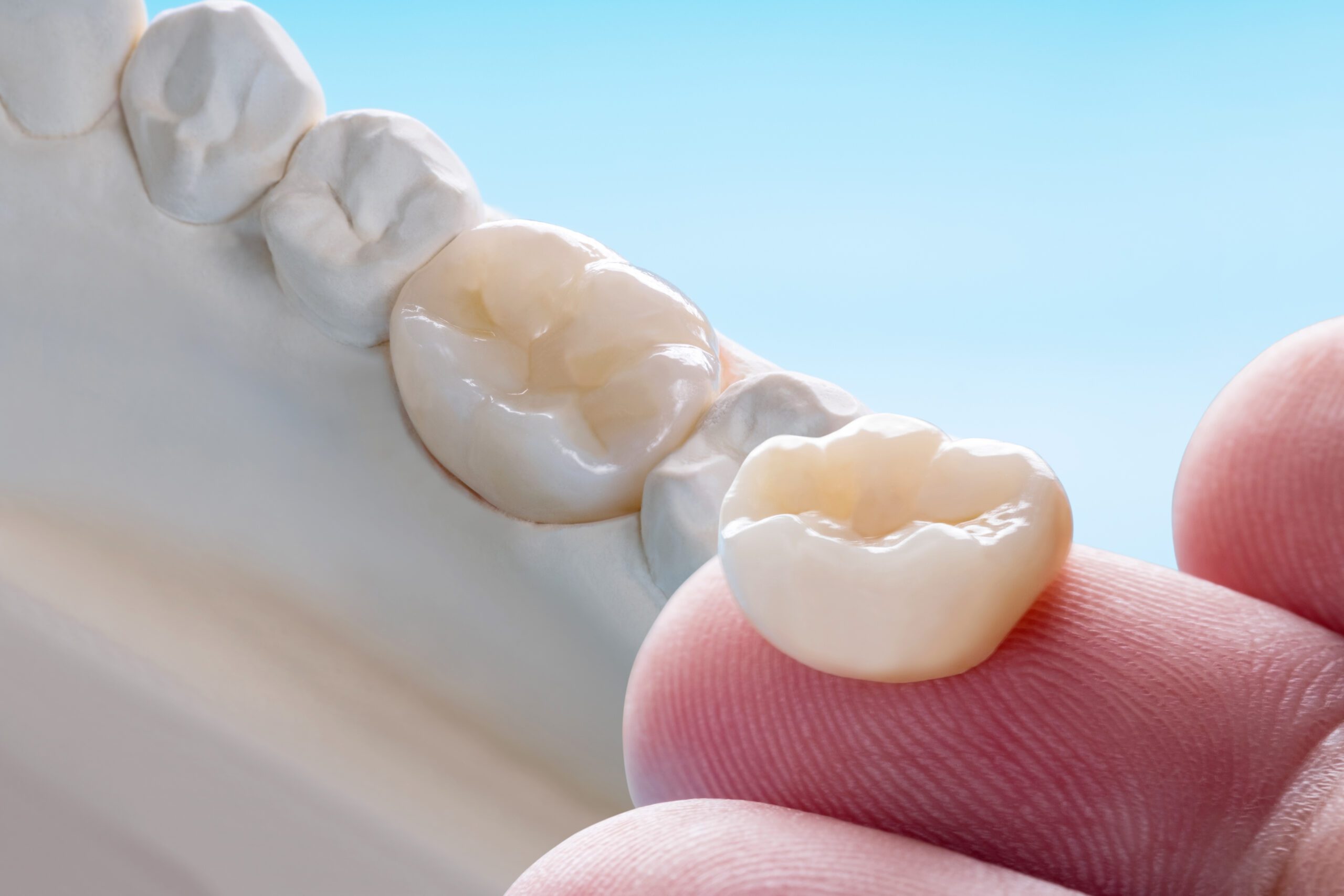 How Much Do Dental Crowns Cost In Rosenberg, TX?