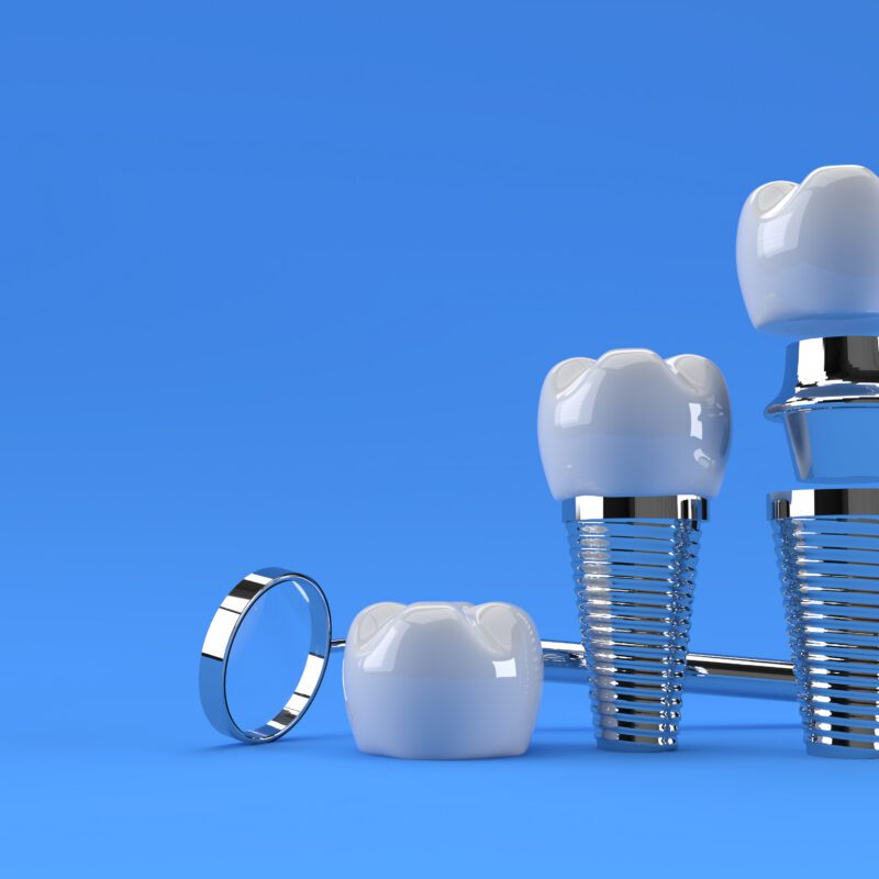 Delta Dental Dentist in Houston, TX | Best Dental