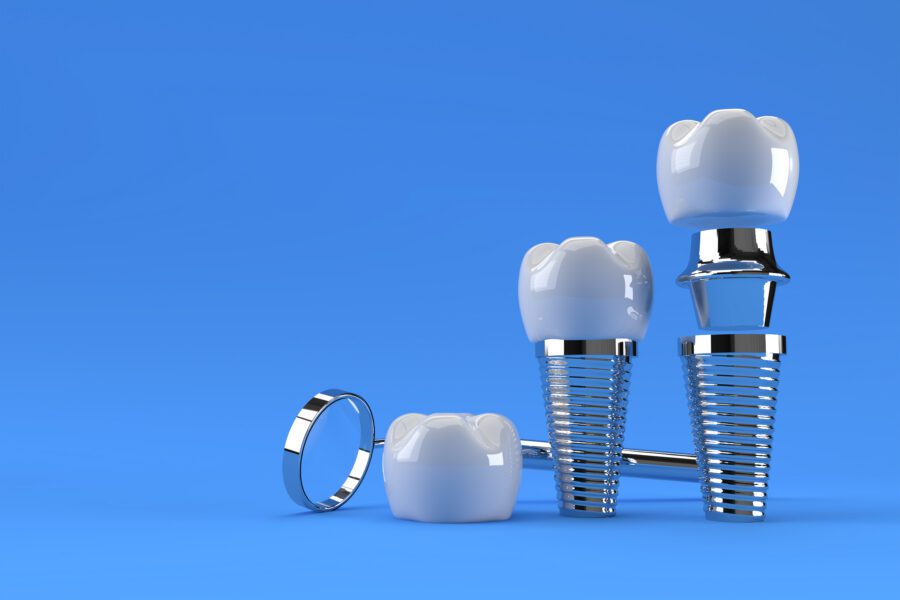 Delta Dental Dentist in Houston, TX | Best Dental