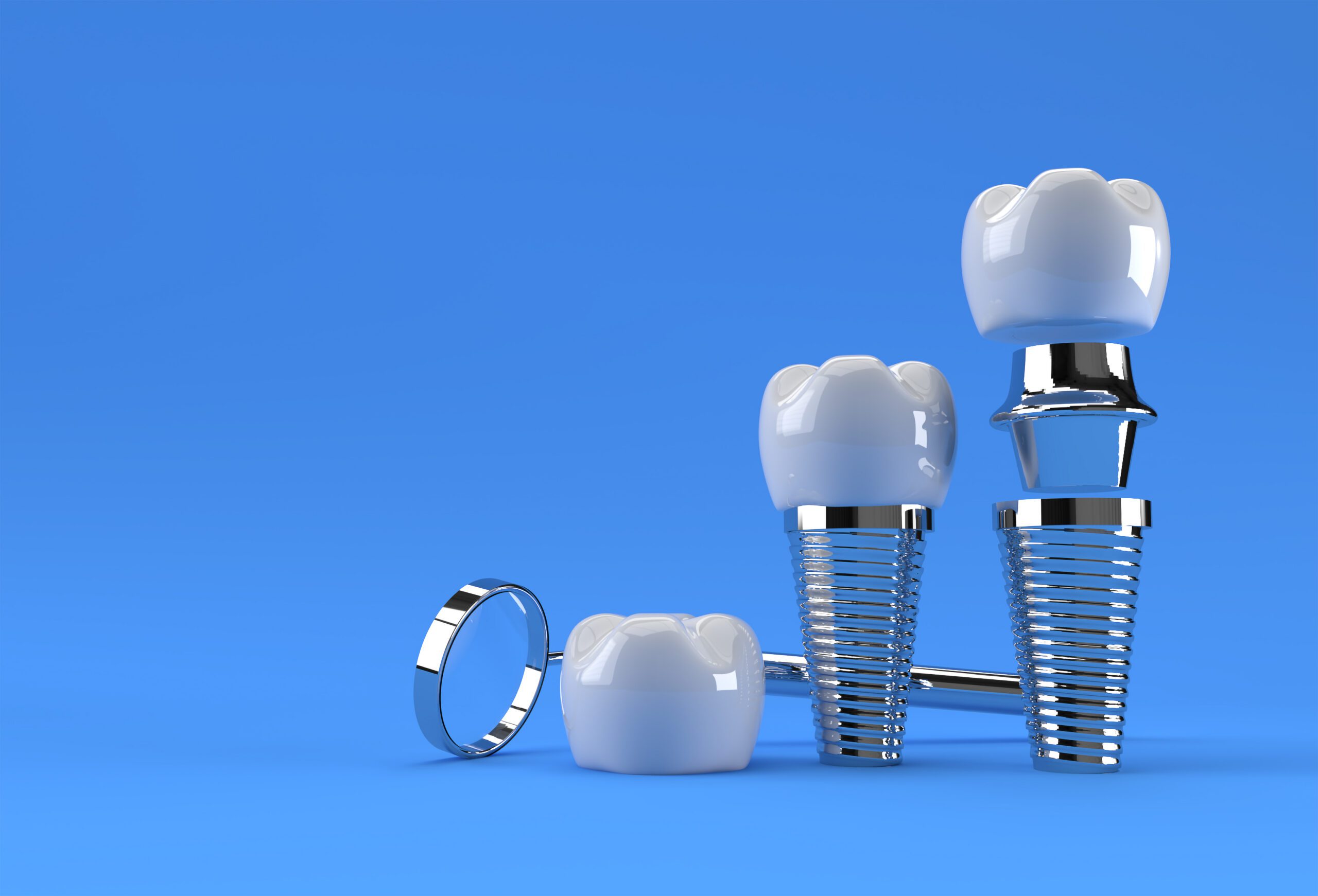 Finding a Delta Dental Dentist In Houston, TX