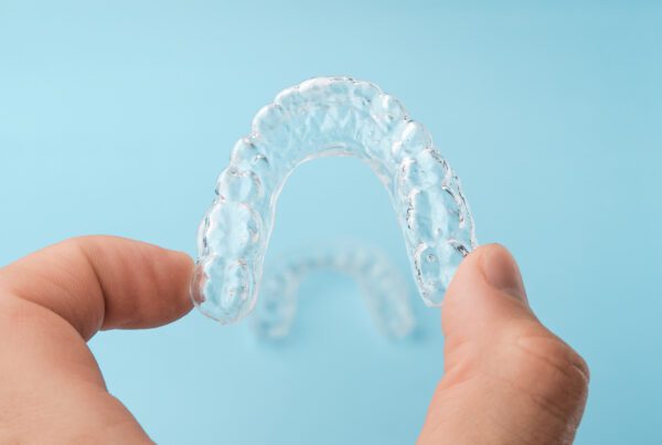 Invisalign Cost Houston, TX | Best Dental