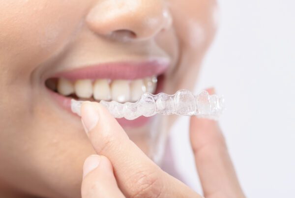 Invisalign Cost Sugar Land, TX | Best Dental