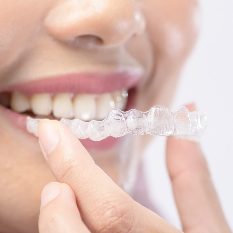 Invisalign Cost Sugar Land, TX | Best Dental