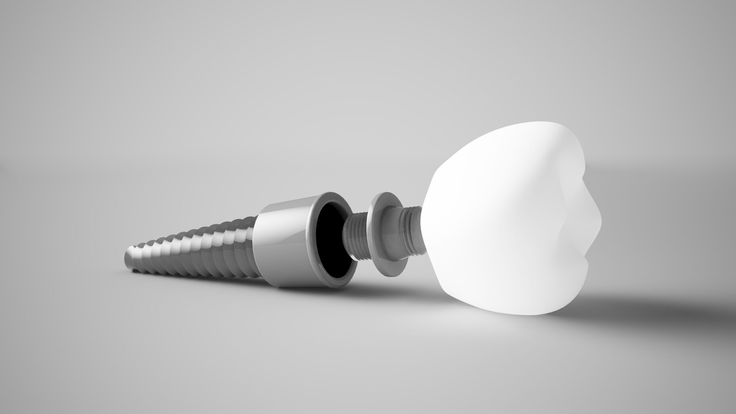 Dental implant 3D rendering at Best Dental near Sugar Land, TX. Affordable single-tooth implant special at $1,995 by Dr. Sonny Naderi, including titanium post, abutment, and porcelain crown.