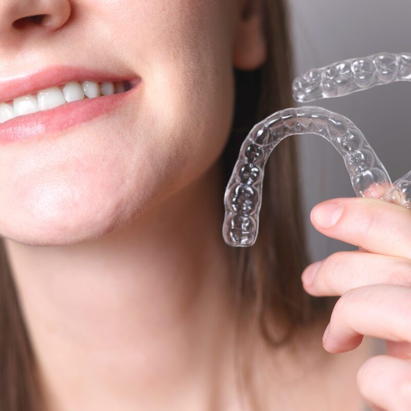 How Much Is Invisalign With Insurance? | Best Dental