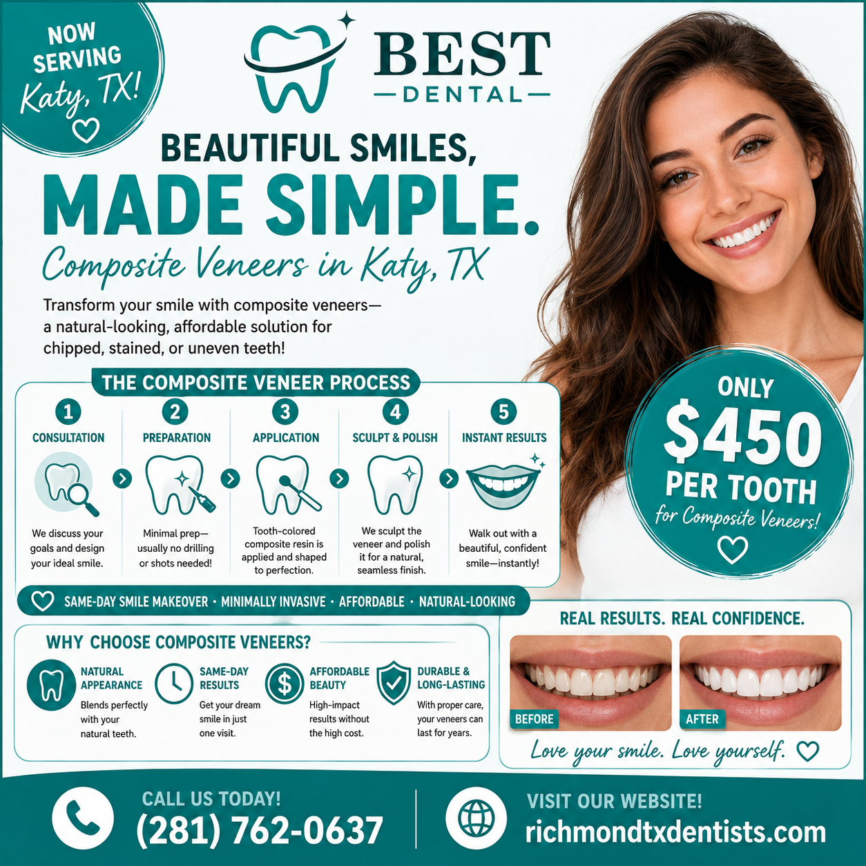 Affordable composite veneers near Katy TX at Best Dental