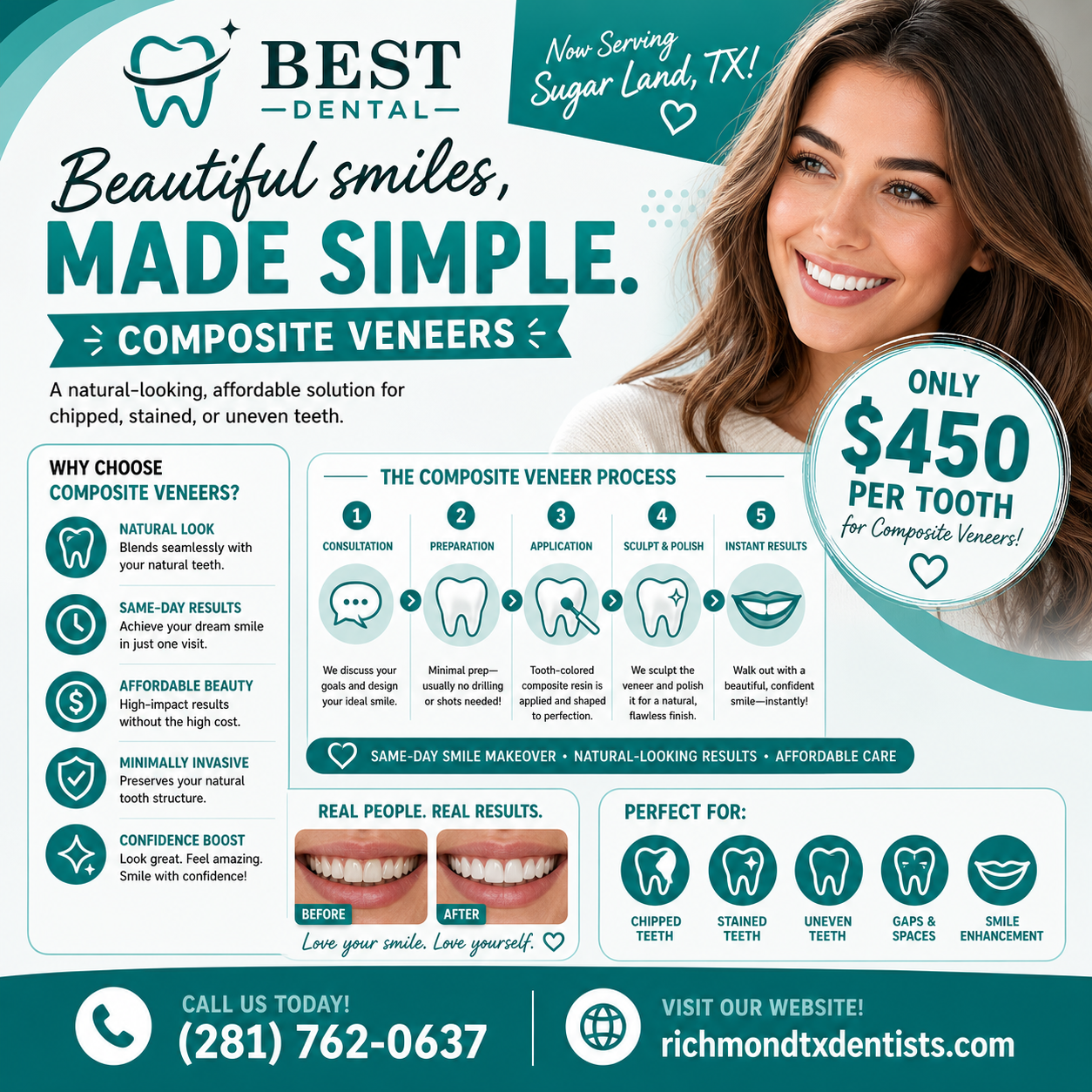 Composite veneers near Sugar Land TX at Best Dental