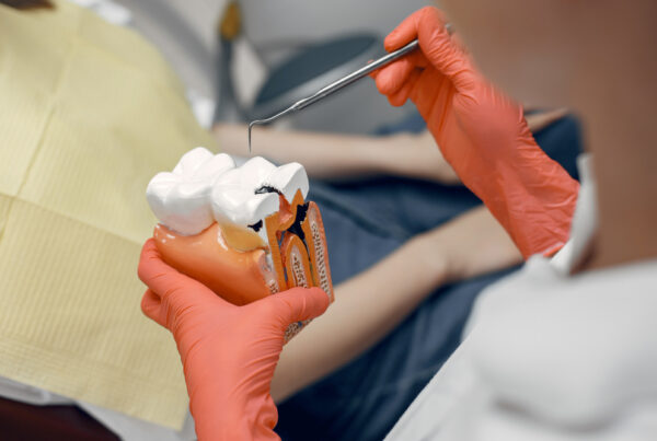 Failed Root Canal | Symptoms & Treatment | Best Dental Richmond, TX