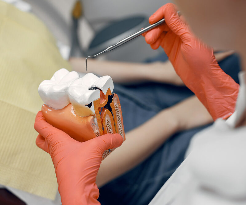 Failed Root Canal | Symptoms & Treatment | Best Dental Richmond, TX