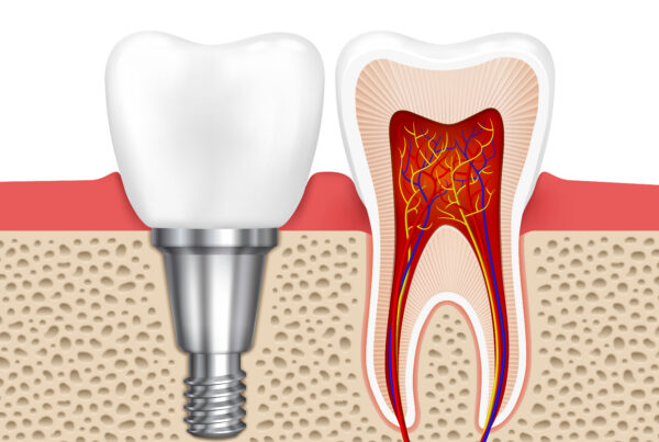 Dental Price Comparison