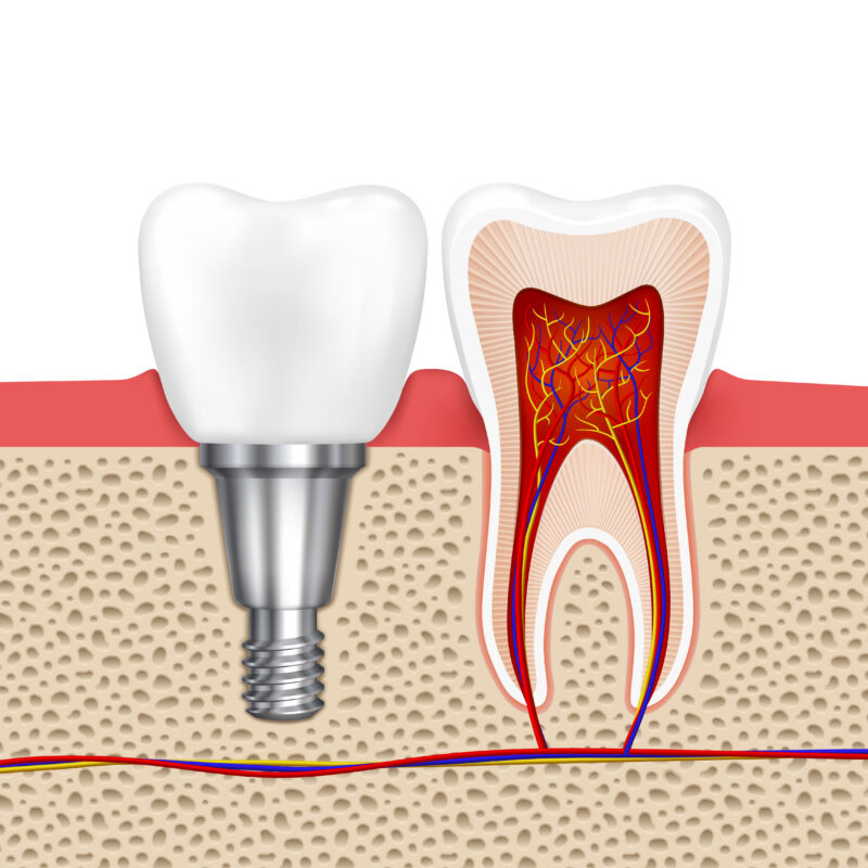 Dental Price Comparison