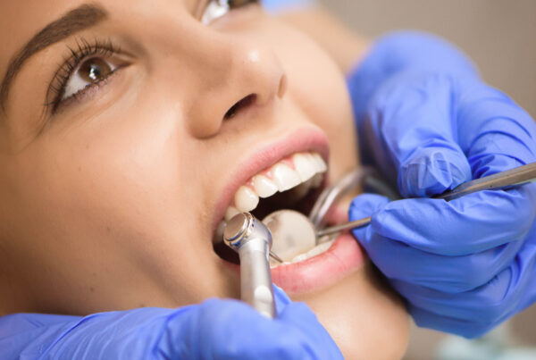 Switching To A New Dentist Near Me | Houston TX | Best Dental