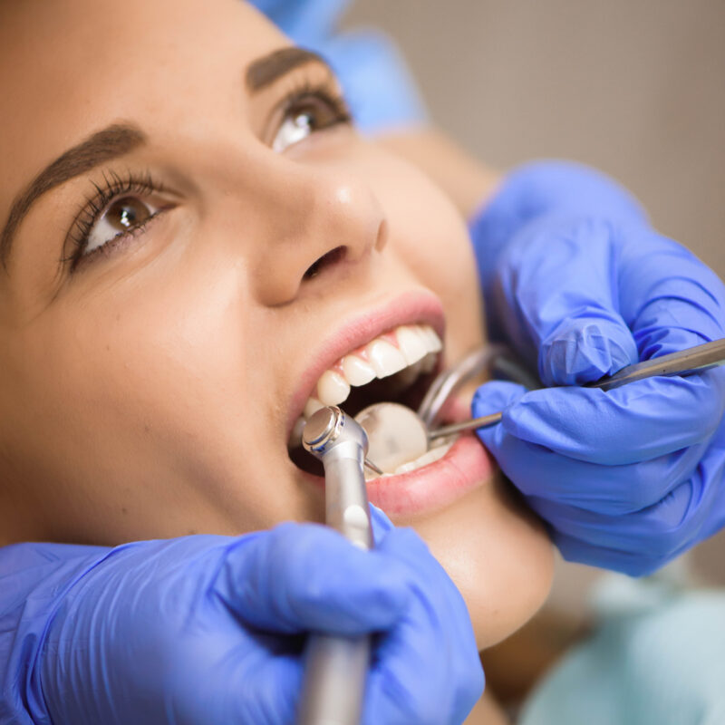Switching To A New Dentist Near Me | Houston TX | Best Dental