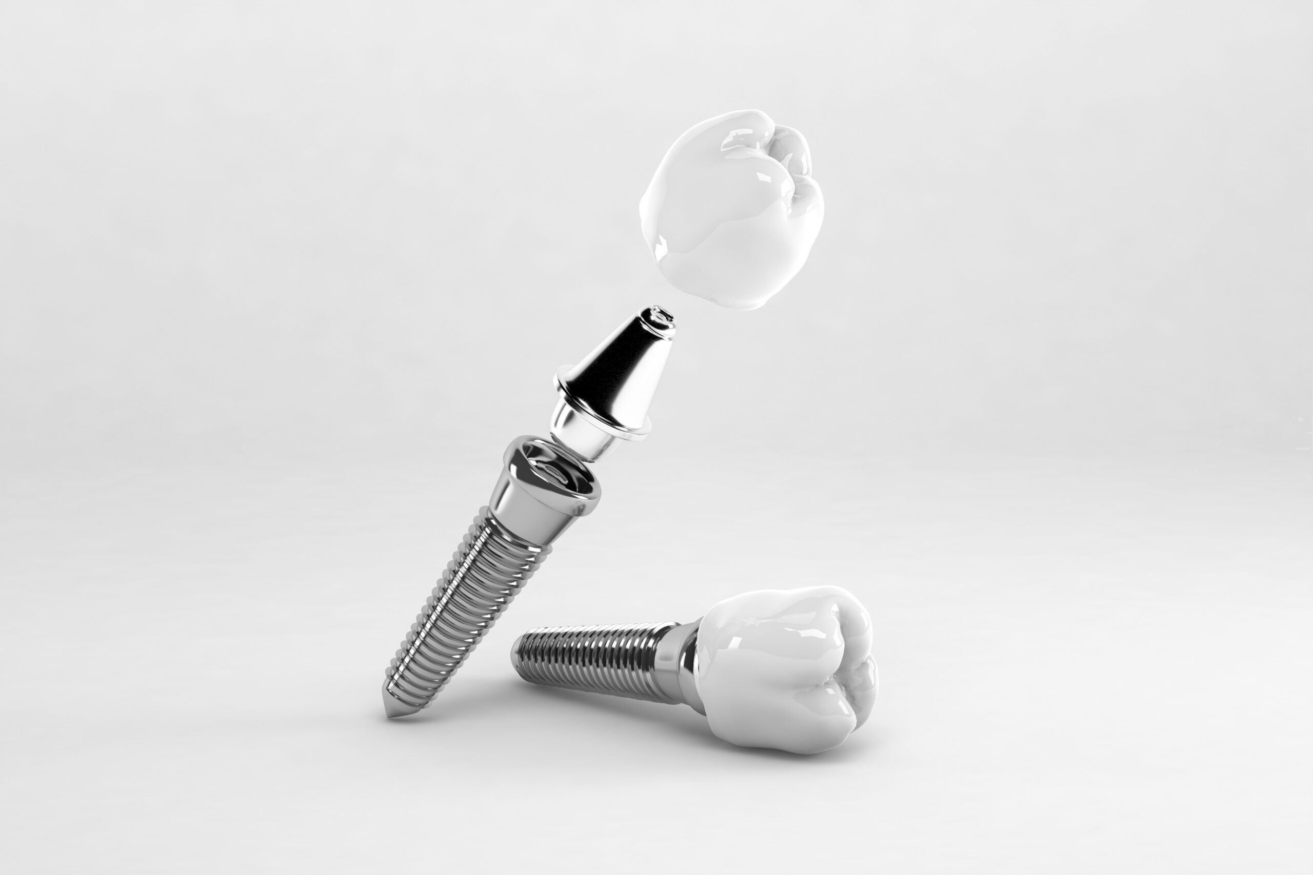 Non-Surgical Dental Implants Near Me | Houston, TX
